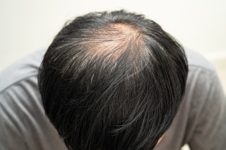 Bald in the middle head and begin no loss hair glabrous of mature Asian business smart active office...