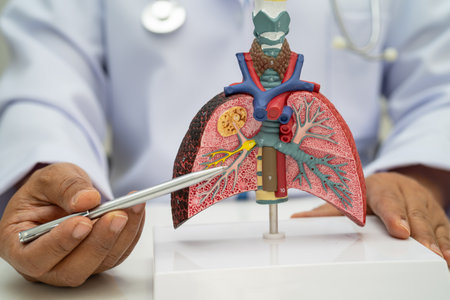 Pneumonia, lung cancer, Asian doctor holding human anatomy model for study diagnosis and treatment in hospital.の写真素材