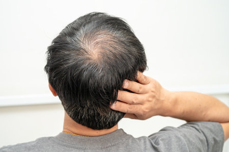 Bald in the middle head and begin no loss hair glabrous of mature Asian business smart active office...