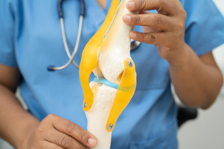 Osteoarthritis of the knee, Doctor holding human knee joint orthopedic anatomy model in hospital.の写真素材