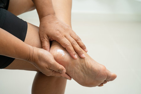 Asian woman care feet with cracked and dry heel skin cream at home.の写真素材