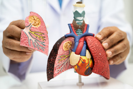 Pneumonia, lung cancer, Asian doctor holding human anatomy model for study diagnosis and treatment in hospital.の写真素材