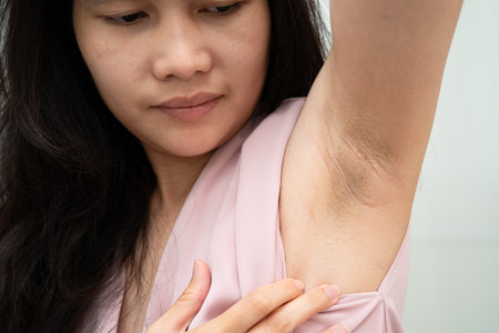 Asian woman have problem black armpit beauty skin care.の写真素材