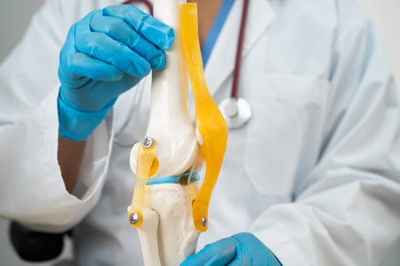 Osteoarthritis of the knee, Doctor holding human knee joint orthopedic anatomy model in hospital.