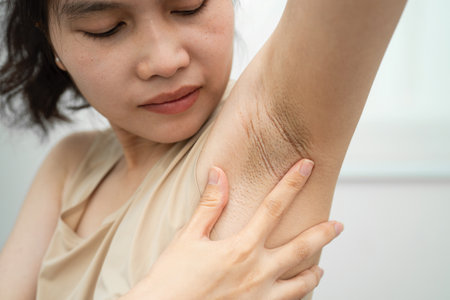 Asian woman have problem black armpit beauty skin care.