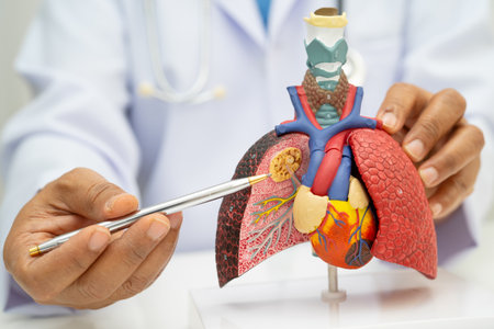 Pneumonia, lung cancer, Asian doctor holding human anatomy model for study diagnosis and treatment...