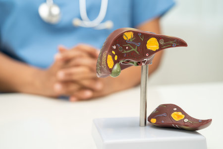 Cirrhosis, Liver cancer, fatty liver, Asian doctor with liver human anatomy model in World Hepatitis Day at hospital.の写真素材