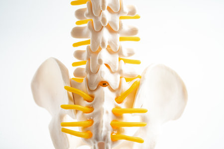 Lumbar spine displaced herniated disc fragment, spinal nerve and bone. Model for treatment medical...