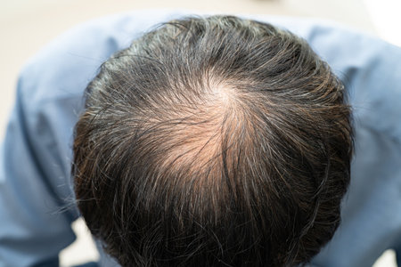 Bald in the middle head and begin no loss hair glabrous of mature Asian business smart active office...