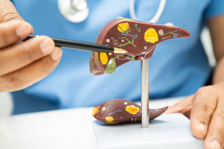 Cirrhosis, Liver cancer, fatty liver, Asian doctor with liver human anatomy model in World Hepatitis Day at hospital.の写真素材