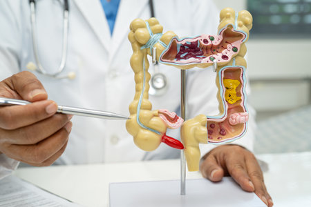 Intestine, appendix and digestive system, doctor holding anatomy model for study diagnosis and treatment in hospital.の写真素材
