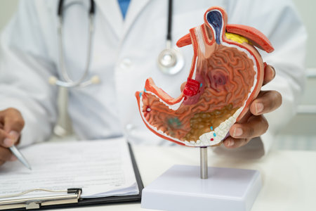 Stomach disease, doctor holding anatomy model for study diagnosis and treatment in hospital.の写真素材