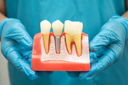 Asian dentist holding dental implant, artificial tooth roots into jaw, root canal of dental...