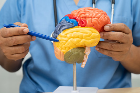 Alzheimer disease, Asian doctor holding brain anatomy model for study diagnosis and treatment in hospital.の写真素材
