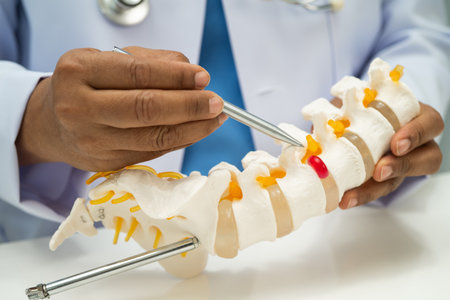 Doctor with lumbar vertebra bone skeleton and nerve model for treatment in the orthopedic department.の写真素材