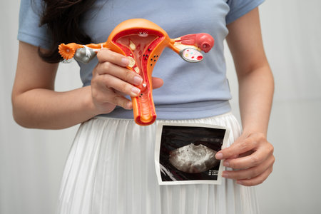 Uterus ultrasound, Asian woman holding human anatomy model.の写真素材