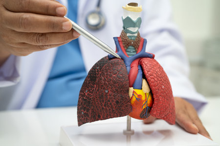 Pneumonia, lung cancer, Asian doctor holding human anatomy model for study diagnosis and treatment...