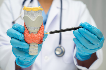 Hyperthyroidism, Overactive Thyroid, Thyroid Lymphoma, doctor with thyroid gland human anatomy model in hospital.の写真素材