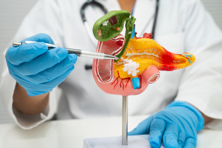 Pancreatitis, pancreatic cancer, Asian doctor with pancreas, gallbladder and bile duct human anatomy...