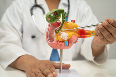 Pancreatitis, pancreatic cancer, Asian doctor with pancreas, gallbladder and bile duct human anatomy model at hospital.の写真素材