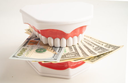 Treatment dental care cost, dental expense or fee, banknote money with teeth model.
