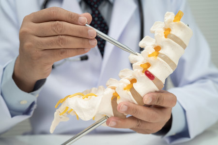 Asian doctor holding spinal nerve and bone model, Lumbar spine displaced herniated disc fragment for...