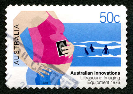AUSTRALIA - CIRCA 2004: A used postage stamp from Australia, celebrating Australian Innovations - this one commemorating Ultrasound Imaging Equipment, circa 2004.のeditorial素材