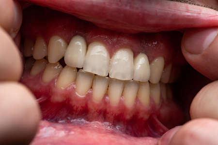 Photo of young man with open mouth, showing teethの写真素材