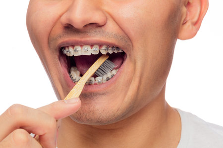 young hispanic man with orthodontic braces brushes his teeth with biodegradable toothbrush on white background, one personの写真素材