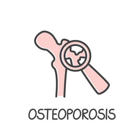hip bone, magnifier and osteoporosis word - vector illustrationのイラスト素材