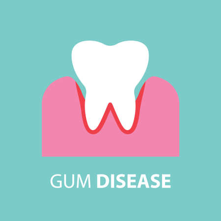gum disease concept- vector illustrationのイラスト素材