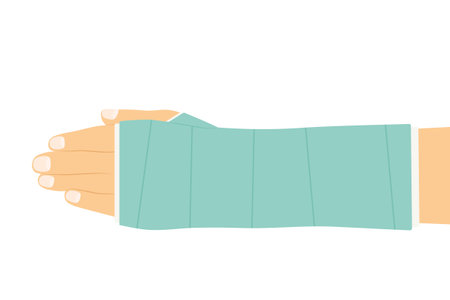 broken hand with plaster - vector illustrationのイラスト素材