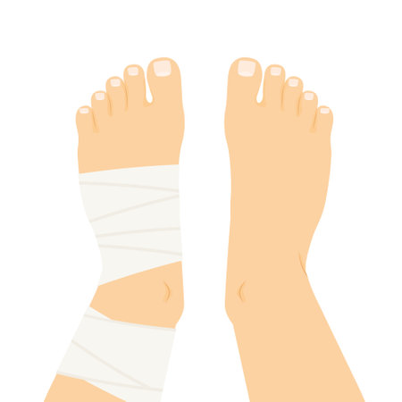 compression bandage wrapped around the twisted ankle- vector illustrationのイラスト素材