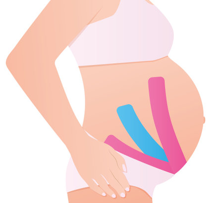 kinesio taping on pregnant woman -vector illustrationのイラスト素材