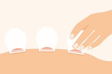 medical cupping therapy on the back- vector illustrationのイラスト素材