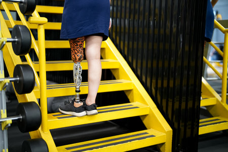 Portrait of disabled athlete woman with prosthetic leg in fitness gymの写真素材