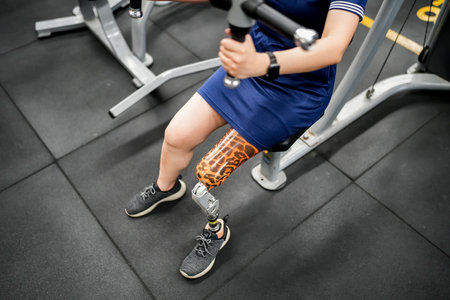Portrait of disabled athlete woman with prosthetic leg in fitness gymの写真素材