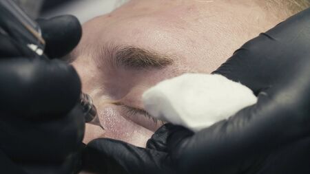 Permanent make-up of dark circles under the eyesの写真素材