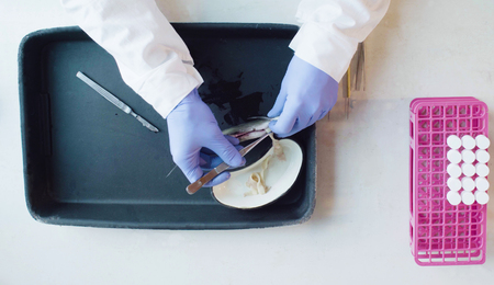 A scientist biologist extracting worms from abdomen of the fishの写真素材