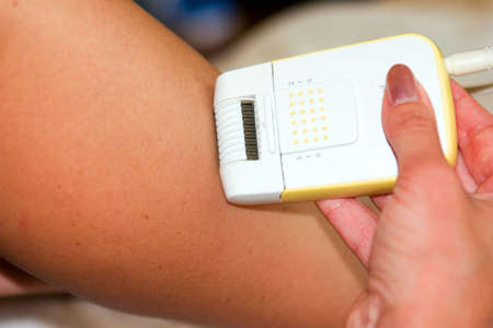 epilationの写真素材