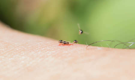 Drosophila are swarming wound on the skin.の写真素材