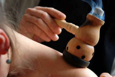 Moxa pipe application for treatment of the patientの写真素材