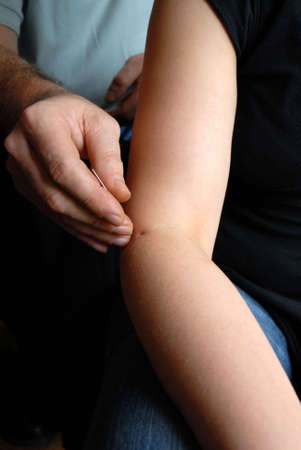 The doctor uses needles for treatment of the patientの写真素材