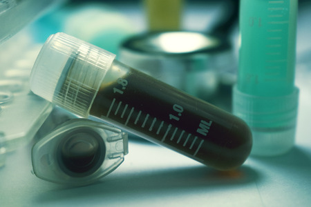 Stem Cell Vial and Laboratory Glasswareの写真素材