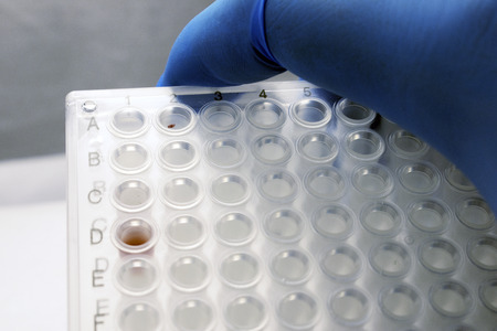 Gloved Hand Holding PCR Plateの写真素材
