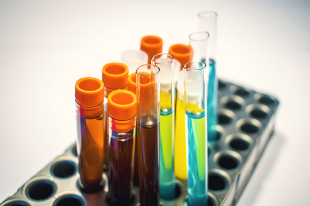 colorful laboratory test tubes, biochemistry blood tests, urine test,  tests tube, medical analysis, research concept, fertility research, stem cell fluidsの写真素材