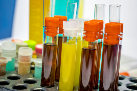 colorful laboratory test tubes, biochemistry blood tests, urine test,  tests tube, medical analysis, research concept, fertility research, stem cell fluidsの写真素材