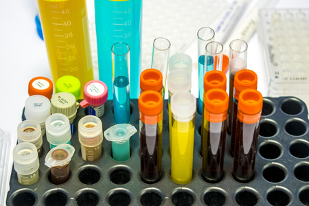 colorful laboratory test tubes, biochemistry blood tests, urine test,  tests tube, medical analysis, research concept, fertility research, stem cell fluidsの写真素材