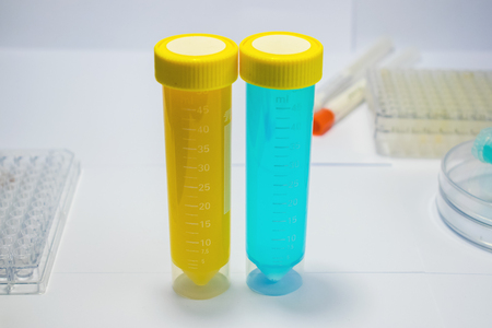 colorful laboratory test tubes, biochemistry blood tests, urine test,  tests tube, medical analysis, research concept, fertility research, stem cell fluidsの写真素材