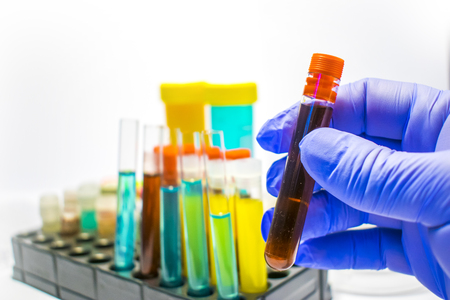 colorful laboratory test tubes, biochemistry blood tests, urine test,  tests tube, medical analysis, research concept, fertility research, stem cell fluidsの写真素材